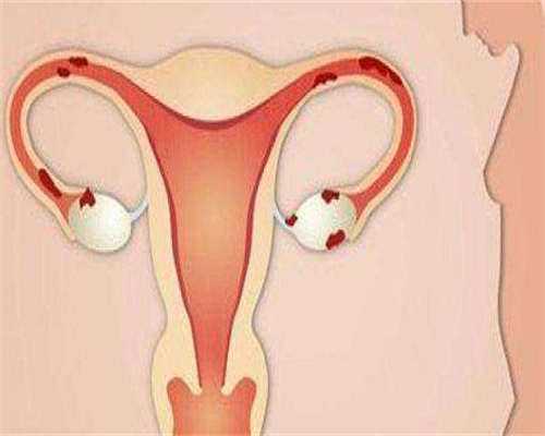 安医试管捐卵_试管捐卵经历,试管婴儿难吗,试管助孕医院
